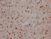 IHC image of CSB-PA618018DA01HU diluted at 1:100 and staining in paraffin-embedded human brain tissue performed on a Leica BondTM system. After dewaxing and hydration, antigen retrieval was mediated by high pressure in a citrate buffer (pH 6.0). S...