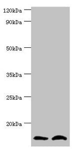 Western blot All lanes: NEDD8 antibody at 8ug/ml Lane 1: Mouse heart tissue Lane 2: Mouse spleen tissue Secondary Goat polyclonal to rabbit IgG at 1/10000 dilution Predicted band size: 9 kDa Observed band size: 9 kDa