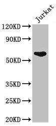 Western Blot Positive WB detected in: Jurkat whole cell lysate All lanes: UAP1 antibody at 2.5µg/ml Secondary Goat polyclonal to rabbit IgG at 1/50000 dilution Predicted band size: 59, 58 kDa Observed band size: 59 kDa