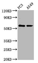 Western Blot Positive WB detected in: PC-3 whole cell lysate, A549 whole cell lysate All lanes: CYP1B1 antibody at 6.62ug/ml Secondary Goat polyclonal to rabbit IgG at 1/50000 dilution Predicted band size: 61 kDa Observed band size: 61 kDa