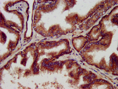 IHC image of CSB-PA618094LA01HU diluted at 1:500 and staining in paraffin-embedded human prostate tissue performed on a Leica BondTM system. After dewaxing and hydration, antigen retrieval was mediated by high pressure in a citrate buffer (pH 6.0)...