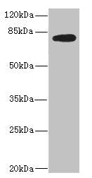 Western blot All lanes: MEP1B antibody IgG at 2.36ug/ml + Mouse kidney tissue Secondary Goat polyclonal to rabbit IgG at 1/10000 dilution Predicted band size: 80 kDa Observed band size: 80 kDa