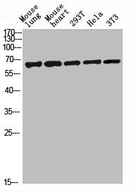 Western blot analysis of mouse-lung mouse-lung lysate, antibody was diluted at 2000. Secondary antibody was diluted at 1:20000