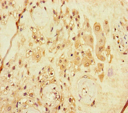 Immunohistochemistry of paraffin-embedded human placenta tissue using CSB-PA618628LA01HU at dilution of 1:100