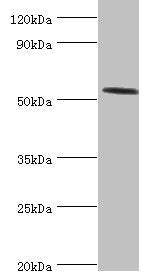 Western blot All lanes: Hyaluronidase-2 antibody at 4ug/ml + Mouse lung tissue Secondary Goat polyclonal to rabbit IgG at 1/10000 dilution Predicted band size: 54 kDa Observed band size: 54 kDa