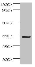Western blot All lanes: Aminoacyl tRNA synthase complex-interacting multifunctional protein 1 antibody at 2ug/ml + HepG2 whole cell lysate Secondary Goat polyclonal to rabbit IgG at 1/10000 dilution Predicted band size: 35, 38 kDa Observed band si...