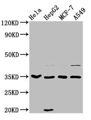 Western Blot Positive WB detected in: Hela whole cell lysate, HepG2 whole cell lysate, MCF-7 whole cell lysate, A549 whole cell lysate All lanes: AIMP1 antibody at 3.7µg/ml Secondary Goat polyclonal to rabbit IgG at 1/50000 dilution Predicted band...