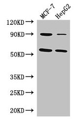 Western Blot Positive WB detected in: MCF-7 whole cell lysate, HepG2 whole cell lysate All lanes: FOXC1 antibody at 3µg/ml Secondary Goat polyclonal to rabbit IgG at 1/50000 dilution Predicted band size: 57 kDa Observed band size: 57 kDa