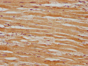 IHC image of CSB-PA618751LA01HU diluted at 1:100 and staining in paraffin-embedded human heart tissue performed on a Leica BondTM system. After dewaxing and hydration, antigen retrieval was mediated by high pressure in a citrate buffer (pH 6.0). S...
