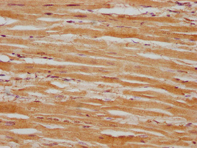 IHC image of CSB-PA618751LA01HU diluted at 1:100 and staining in paraffin-embedded human heart tissue performed on a Leica BondTM system. After dewaxing and hydration, antigen retrieval was mediated by high pressure in a citrate buffer (pH 6.0). S...