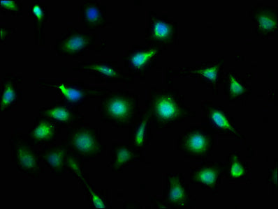Immunofluorescence staining of SH-SY5Y cells with CSB-PA618752LA01HU at 1:133, counter-stained with DAPI. The cells were fixed in 4% formaldehyde, permeabilized using 0.2% Triton X-100 and blocked in 10% normal Goat Serum. The cells were then incu...