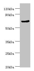 Western blot All lanes: CDC16 antibody at 4µg/ml + Jurkat whole cell lysate Secondary Goat polyclonal to rabbit IgG at 1/10000 dilution Predicted band size: 72, 66, 61 kDa Observed band size: 72 kDa