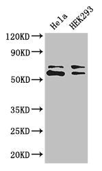 Western Blot Positive WB detected in: Hela whole cell lysate, HEK293 whole cell lysate All lanes: COASY antibody at 3.4ug/ml Secondary Goat polyclonal to rabbit IgG at 1/50000 dilution Predicted band size: 63, 66 kDa Observed band size: 63, 66 kDa