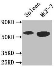 Western Blot Positive WB detected in: Mouse spleen tissue, MCF-7 whole cell lysate All lanes: AMPK1 antibody at 3ug/ml Secondary Goat polyclonal to rabbit IgG at 1/50000 dilution Predicted band size: 65, 66 kDa Observed band size: 65 kDa