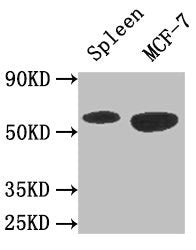 Western Blot Positive WB detected in: Mouse spleen tissue, MCF-7 whole cell lysate All lanes: AMPK1 antibody at 3ug/ml Secondary Goat polyclonal to rabbit IgG at 1/50000 dilution Predicted band size: 65, 66 kDa Observed band size: 65 kDa