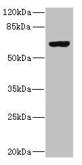 Western blot All lanes: SLC13A2 antibody at 1.29µg/ml + 293T whole cell lysate Secondary Goat polyclonal to rabbit IgG at 1/10000 dilution Predicted band size: 65, 70 kDa Observed band size: 65 kDa