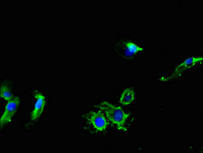 Immunofluorescent analysis of Hela cells using CSB-PA618765LA01HU at dilution of 1:100 and Alexa Fluor 488-congugated AffiniPure Goat Anti-Rabbit IgG(H+L)