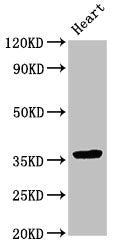 Western Blot Positive WB detected in: Rat heart tissue All lanes: NMI antibody at 3.5ug/ml Secondary Goat polyclonal to rabbit IgG at 1/50000 dilution Predicted band size: 36 kDa Observed band size: 36 kDa