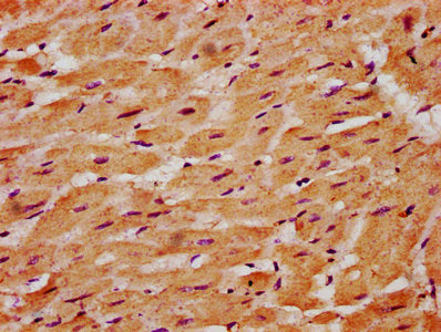 IHC image of CSB-PA618771LA01HU diluted at 1:500 and staining in paraffin-embedded human heart tissue performed on a Leica BondTM system. After dewaxing and hydration, antigen retrieval was mediated by high pressure in a citrate buffer (pH 6.0). S...