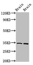 Western Blot Positive WB detected in: Mouse brain tissue, Rat brain tissue All lanes: FOXE3 antibody at 4ug/ml Secondary Goat polyclonal to rabbit IgG at 1/50000 dilution Predicted band size: 34 kDa Observed band size: 34 kDa