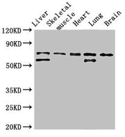 Western Blot Positive WB detected in: Rat liver tissue, Rat skeletal muscle tissue, Mouse heart tissue, Mouse lung tissue, Mouse brain tissue All lanes: BIRC2 antibody at 3.5ug/ml Secondary Goat polyclonal to rabbit IgG at 1/50000 dilution Predict...