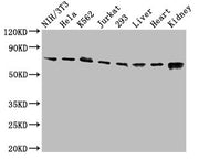 Western Blot Positive WB detected in: NIH/3T3 whole cell lysate, Hela whole cell lysate, K562 whole cell lysate, Jurkat whole cell lysate, 293 whole cell lysate, Rat liver tissue, Mouse heart tissue, Mouse kidney tissue All lanes: RIPK1 antibody a...