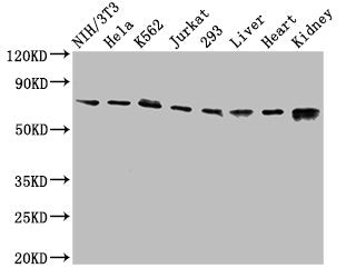 Western Blot Positive WB detected in: NIH/3T3 whole cell lysate, Hela whole cell lysate, K562 whole cell lysate, Jurkat whole cell lysate, 293 whole cell lysate, Rat liver tissue, Mouse heart tissue, Mouse kidney tissue All lanes: RIPK1 antibody a...