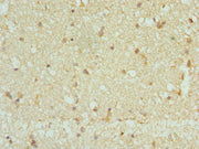 Immunohistochemistry of paraffin-embedded human brain tissue using CSB-PA618786ESR2HU at dilution of 1:100