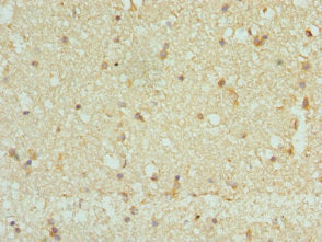 Immunohistochemistry of paraffin-embedded human brain tissue using CSB-PA618786ESR2HU at dilution of 1:100