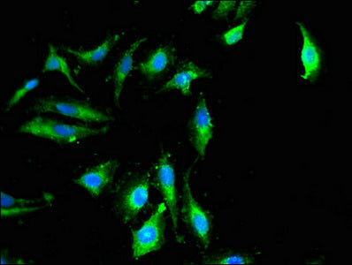 Immunofluorescent analysis of Hela cells using CSB-PA618788LA01HU at dilution of 1:100 and Alexa Fluor 488-congugated AffiniPure Goat Anti-Rabbit IgG(H+L)
