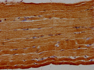 IHC image of CSB-PA618789LA01HU diluted at 1:30 and staining in paraffin-embedded human skeletal muscle tissue performed on a Leica BondTM system. After dewaxing and hydration, antigen retrieval was mediated by high pressure in a citrate buffer (p...