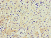 Immunohistochemistry of paraffin-embedded human liver tissue using CSB-PA618796ESR1HU at dilution of 1:100