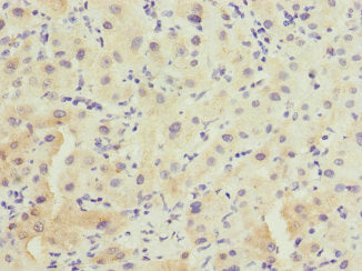 Immunohistochemistry of paraffin-embedded human liver tissue using CSB-PA618796ESR1HU at dilution of 1:100