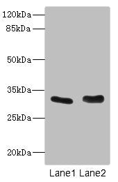 Western blot All lanes: FHL3 antibody at 1.42ug/ml Lane 1: Human placenta tissue Lane 2: K562 whole cell lysate Secondary Goat polyclonal to rabbit IgG at 1/10000 dilution Predicted band size: 31 kDa Observed band size: 31 kDa