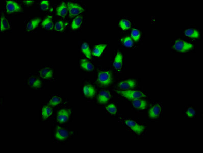 Immunofluorescence staining of Hela cells with CSB-PA618797LA01HU at 1:233, counter-stained with DAPI. The cells were fixed in 4% formaldehyde, permeabilized using 0.2% Triton X-100 and blocked in 10% normal Goat Serum. The cells were then incubat...