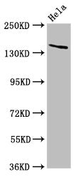 Western Blot Positive WB detected in: Hela whole cell lysate All lanes: LAMC2 antibody at 5ug/ml Secondary Goat polyclonal to rabbit IgG at 1/50000 dilution Predicted band size: 131, 122 kDa Observed band size: 140 kDa