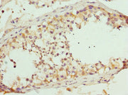 Immunohistochemistry of paraffin-embedded human testis tissue using CSB-PA618811ESR1HU at dilution of 1:100