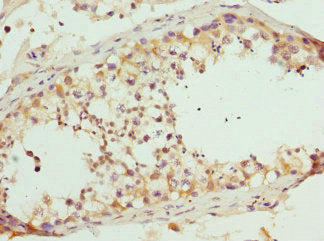 Immunohistochemistry of paraffin-embedded human testis tissue using CSB-PA618811ESR1HU at dilution of 1:100