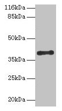 Western blot All lanes: CYLC2 antibody at 12µg/ml + 293T whole cell lysate Secondary Goat polyclonal to rabbit IgG at 1/10000 dilution Predicted band size: 40 kDa Observed band size: 40 kDa