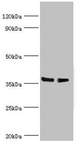 Western blot All lanes: HNRNPD antibody at 4µg/ml Lane 1: Hela whole cell lysate Lane 2: 293T whole cell lysate Secondary Goat polyclonal to rabbit IgG at 1/10000 dilution Predicted band size: 39, 37, 33, 31 kDa Observed band size: 39 kDa