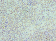 Immunohistochemistry of paraffin-embedded human tonsil tissue using CSB-PA618874DSR2HU at dilution of 1:100
