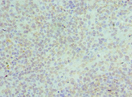 Immunohistochemistry of paraffin-embedded human tonsil tissue using CSB-PA618874DSR2HU at dilution of 1:100
