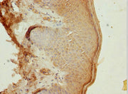 Immunohistochemistry of paraffin-embedded human skin tissue using CSB-PA618875ESR2HU at dilution of 1:100