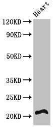 Western Blot Positive WB detected in: Mouse heart tissue All lanes: RCAN2 antibody at 3ug/ml Secondary Goat polyclonal to rabbit IgG at 1/50000 dilution Predicted band size: 22, 28 kDa Observed band size: 22 kDa