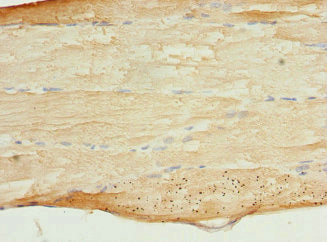 Immunohistochemistry of paraffin-embedded human skeletal muscle tissue using CSB-PA618884ESR2HU at dilution of 1:100