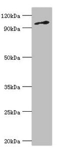 Western blot All lanes: DNA replication licensing factor MCM6 antibody at 3ug/ml + Jurkat whole cell lysate Secondary Goat polyclonal to rabbit IgG at 1/10000 dilution Predicted band size: 93 kDa Observed band size: 93 kDa