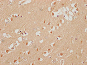 IHC image of CSB-PA618895LA01HU diluted at 1:200 and staining in paraffin-embedded human brain tissue performed on a Leica BondTM system. After dewaxing and hydration, antigen retrieval was mediated by high pressure in a citrate buffer (pH 6.0). S...
