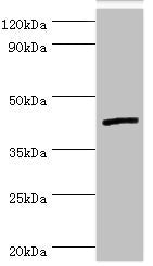 Western blot All lanes: Interleukin-13 receptor subunit alpha-2 antibody at 5ug/ml + Hela whole cell lysate Secondary Goat polyclonal to rabbit IgG at 1/10000 dilution Predicted band size: 44 kDa Observed band size: 44 kDa