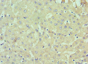 Immunohistochemistry of paraffin-embedded human liver tissue using CSB-PA618901ESR2HU at dilution of 1:100
