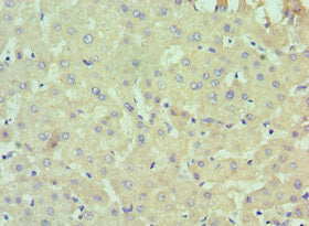 Immunohistochemistry of paraffin-embedded human liver tissue using CSB-PA618901ESR2HU at dilution of 1:100